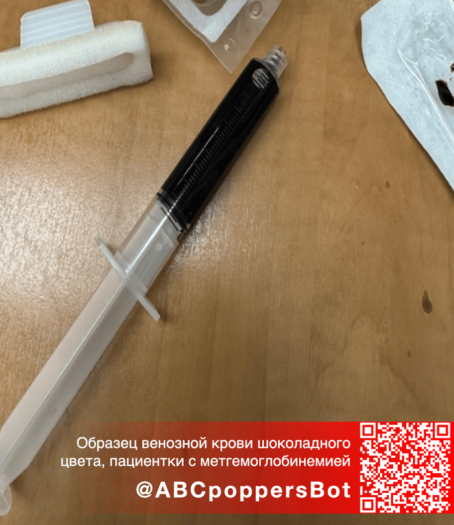Если принять попперс внутрь в Ставрополе это вызывает метгемоглобинемию. Смертельное состояние Если принять попперс внутрь в Ставрополе это вызывает метгемоглобинемию. Смертельное состояние